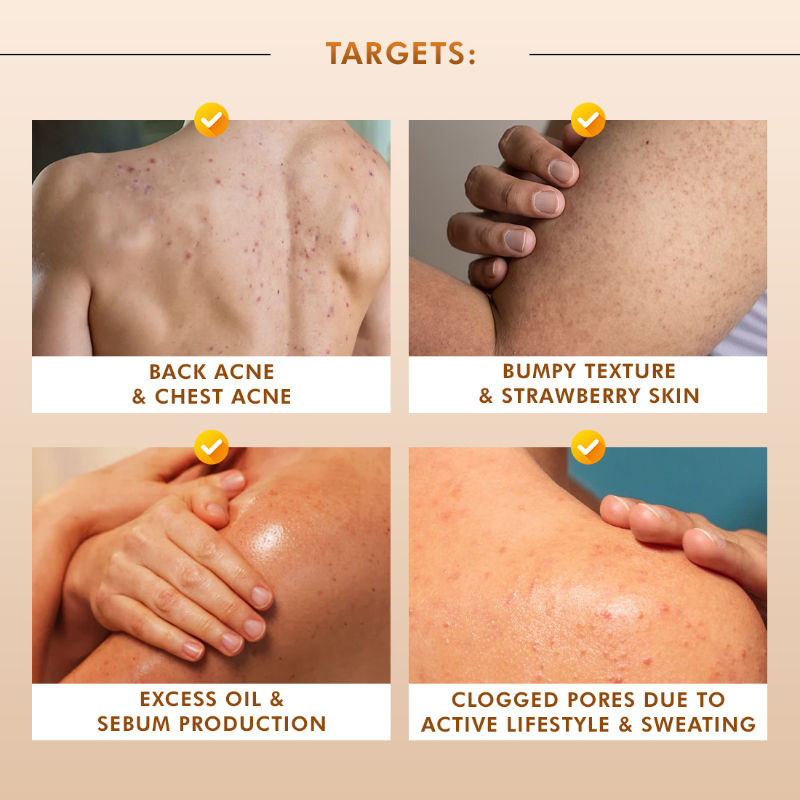 7% Exfoliating Body Wash- 1% Salicylic 2% Lactic Acid | Shower Gel to Reduce Body Acne