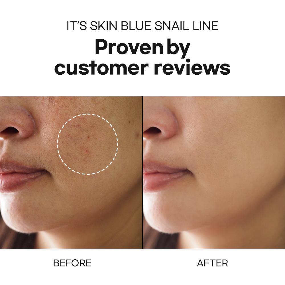 Blue Snail Serum