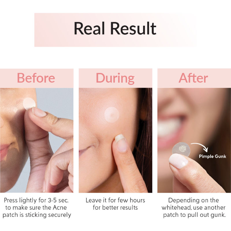 Spot Clearing Acne Pimple Patch